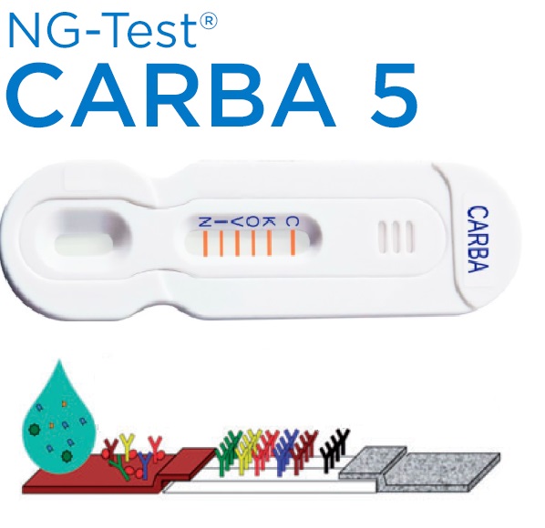 Test Rápido Para la Identificación de Enterobacterias Productoras de Carbapenemasas